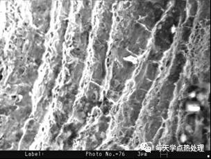 韌窩帶.webp.jpg 韌窩帶.webp.jpg